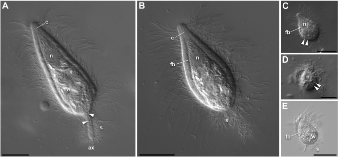 Spirotrichonymphea (Parabasalia) symbionts of the termite Paraneotermes simplicicornis